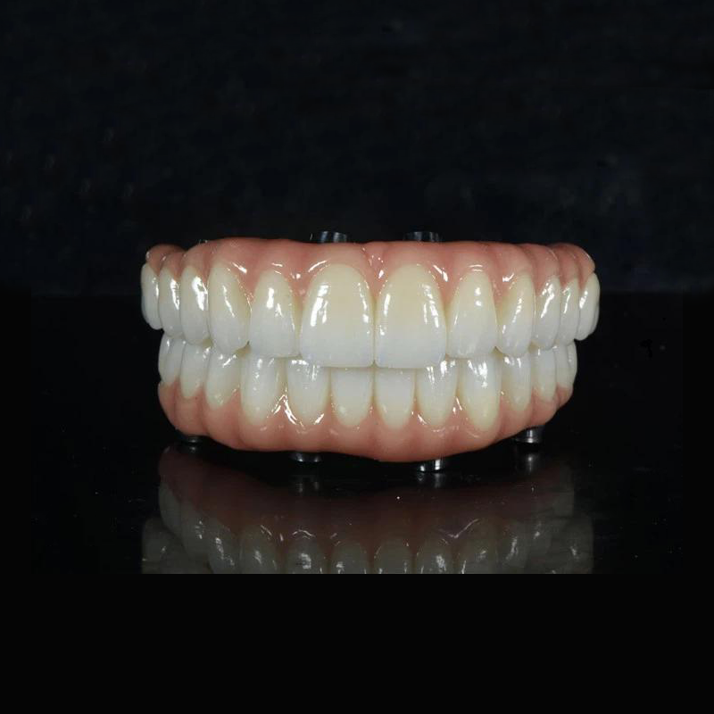 UILE-AR -X DROICHEAD ZIRCONIA