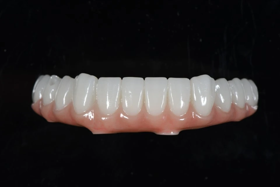 Sainordúil Uile-ar-X Droichead Zirconia