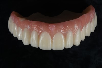 Coróin Sealadach Roisín Aicrileach