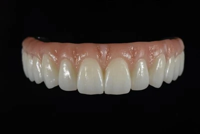 Gach Rud atá Deartha go Digiteach-ar-X Droichead Zirconia
