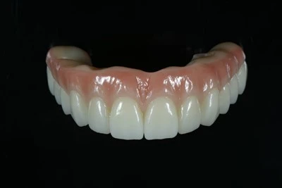 Tíotáiniam-Treisithe Uile-ar-X Zirconia Bridge